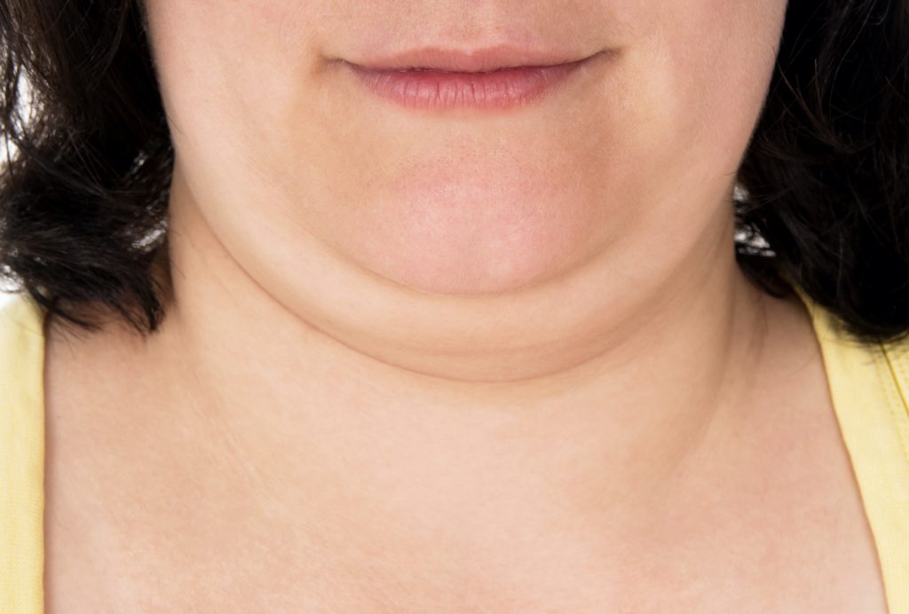 woman with a double chin