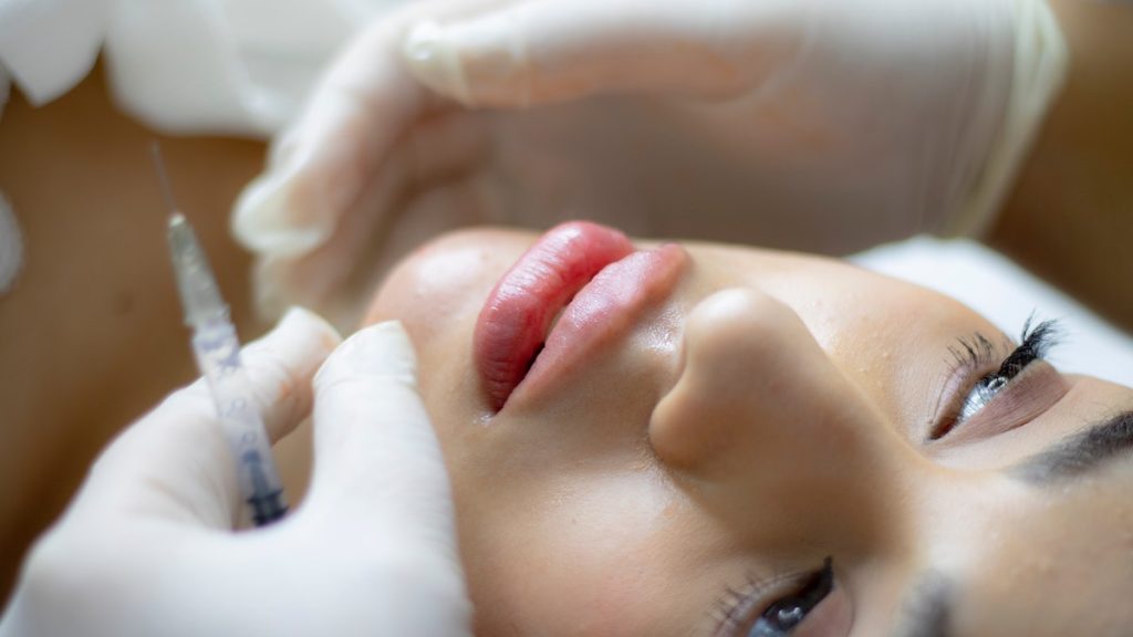 woman getting fillers